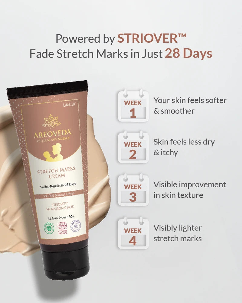 AreoVeda stretch marks cream with Striover technology claims on a gray background